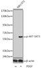 Western blot analysis of extracts from NIH/3T3 using Phospho-AKT(S473) Polyclonal Antibody.