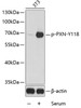 Western blot analysis of extracts from 3T3 cells using Phospho-PXN(Y118) Polyclonal Antibody.