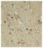 Immunohistochemistry of paraffin-embedded Rat hippocampal region tissue from a model with Alzheimer, using Phospho-Tau(S396) Polyclonal Antibody