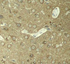 Immunohistochemistry of paraffin-embedded Rat hippocampal region tissue from a model with Alzheimer, using Phospho-Tau(S404) Polyclonal Antibody