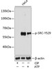 Western blot analysis of extracts of various cell lines using Phospho-SRC(Y529) Polyclonal Antibody at dilution of 1:1000. Hela cells were treated by ATP(5 mM) at 30°C for 1 hour or treated by CIP(20uL/400ul) at 37°C for 1 hour.