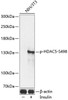 Western blot analysis of extracts of NIH/3T3 cells using Phospho-HDAC5(S498) Polyclonal Antibody at dilution of 1:2000. NIH/3T3 cells were treated by Insulin (100nM) for 10 minutes after serum-starvation overnight.