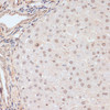 Immunohistochemistry of paraffin-embedded Rat liver using Phospho-BRCA1(S1423) Polyclonal Antibody at dilution of  1:100 (40x lens).