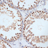 Immunohistochemistry of paraffin-embedded Rat testis using Phospho-BRCA1(S1423) Polyclonal Antibody at dilution of  1:100 (40x lens).
