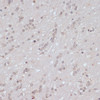 Immunohistochemistry of paraffin-embedded Rat brain using Phospho-BRCA1(S1423) Polyclonal Antibody at dilution of  1:100 (40x lens).