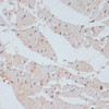 Immunohistochemistry of paraffin-embedded Rat heart using Phospho-BRCA1(S1423) Polyclonal Antibody at dilution of  1:100 (40x lens).