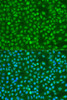 Immunofluorescence analysis of U2OS cells using Phospho-BRCA1(S1423) Polyclonal Antibody at dilution of  1:100. Blue: DAPI for nuclear staining.