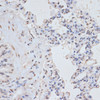 Immunohistochemistry of paraffin-embedded Rat lung using Phospho-MAPK3(Y204) Polyclonal Antibody at dilution of  1:100 (40x lens).