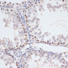 Immunohistochemistry of paraffin-embedded Rat testis using Phospho-MAPK3(Y204) Polyclonal Antibody at dilution of  1:100 (40x lens).