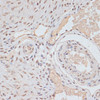 Immunohistochemistry of paraffin-embedded Rat ovary using Phospho-MAPK3(Y204) Polyclonal Antibody at dilution of  1:100 (40x lens).