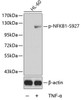 Western blot analysis of extracts from HL60 cells using Phospho-NFKB1(S927) Polyclonal Antibody.