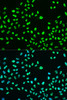 Immunofluorescence analysis of U2OS cells using Phospho-BRCA1(S988) Polyclonal Antibody at dilution of  1:100. Blue: DAPI for nuclear staining.