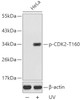 Western blot analysis of extracts from HeLa cells using Phospho-CDK2(T160) Polyclonal Antibody.