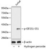 Western blot analysis of extracts from Jurkat cells using Phospho-eIF2α(S51) Polyclonal Antibody.