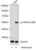 Western blot analysis of extracts from HeLa cells using Phospho-HNF4A(S304) Polyclonal Antibody.