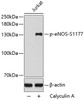 Western blot analysis of extracts of Jurkat cells using Phospho-eNOS(S1177) Polyclonal Antibody.