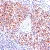 Immunohistochemistry of paraffin-embedded Mouse spleen using Phospho-NF-kB p65(S311) Polyclonal Antibody at dilution of  1:100 (40x lens).