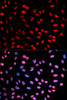 Immunofluorescence analysis of U2OS cells using Phospho-ESPL1(S1126) Polyclonal Antibody