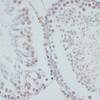 Immunohistochemistry of paraffin-embedded Rat testis using Phospho-ERK1（T202/Y204）/ ERK2（T185/Y187） Polyclonal Antibody at dilution of  1:100 (40x lens).