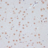 Immunohistochemistry of paraffin-embedded Rat brain using Phospho-ERK1（T202/Y204）/ ERK2（T185/Y187） Polyclonal Antibody at dilution of  1:100 (40x lens).