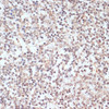 Immunohistochemistry of paraffin-embedded Human tonsil using Phospho-ERK1（T202/Y204）/ ERK2（T185/Y187） Polyclonal Antibody at dilution of  1:100 (40x lens).