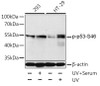 Western blot analysis of extracts of 293 and HT-29 cells using Phospho-p53(S46) Polyclonal Antibody at dilution of 1:1000. 293 cells were treated by UV for 15-30 minutes. HT-29 cells were treated by UV for 15-30 minutes.