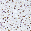 Immunohistochemistry of paraffin-embedded Mouse liver using Phospho-ATF2(T69/T71) Polyclonal Antibody at dilution of  1:100 (40x lens).