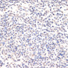 Immunohistochemistry of paraffin-embedded Human placenta using Phospho-Jak2(Y1007/1008) Polyclonal Antibody at dilution of  1:200 (40x lens).