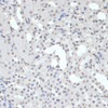 Immunohistochemistry of paraffin-embedded Mouse kidney using Phospho-Jak2(Y1007/1008) Polyclonal Antibody at dilution of  1:200 (40x lens).