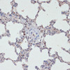 Immunohistochemistry of paraffin-embedded Rat lung using Phospho-Jak2(Y1007/1008) Polyclonal Antibody at dilution of  1:200 (40x lens).