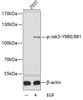 Western blot analysis of extracts of 293T cells using Phospho-Jak3(Y980/981) Polyclonal Antibody.
