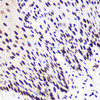 Immunohistochemistry of paraffin-embedded Human esophagus using Phospho-Smad2（S465/467）/Smad3（S423/425) Polyclonal Antibody at dilution of  1:100 (40x lens).