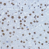 Immunohistochemistry of paraffin-embedded Rat liver using Phospho-SMAD3(T179) Polyclonal Antibody at dilution of  1:200 (40x lens).