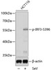 Western blot analysis of extracts of HCT116 cells using Phospho-IRF3(S396) Polyclonal Antibody at dilution of 1:1000.