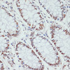 Immunohistochemistry of paraffin-embedded Human colon using Phospho-POLR2A(S5) Polyclonal Antibody at dilution of  1:100 (40x lens).