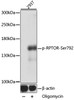 Western blot analysis of extracts of 293T cells using Phospho-RPTOR(Ser792) Polyclonal Antibody at dilution of 1:1000. 293T cells were treated by Oligomycin (0. 5 uM) at 37°C for 30 minutes after serum-starvation overnight.