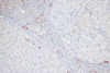 Immunohistochemistry of paraffin-embedded Rat ovary using Phospho-MYL9(T18/S19) Polyclonal Antibody at dilution of  1:100 (20x lens).