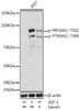 Western blot analysis of extracts of 293T cells using Phospho-P70S6K1(T389) Polyclonal Antibody at dilution of 1:1000. 293T cells were treated by IGF-1 (50 ng/ml) at 37°C for 5 minutes after serum-starvation overnight. 293T cells were treated by 10% FBS at 37°C for 30 minutes after serum-starvation overnight.