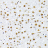 Immunohistochemistry of paraffin-embedded Rat liver using Phospho-Histone H2A(S129) Polyclonal Antibody at dilution of  1:100 (40x lens).