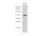 Western Blot analysis of Jurkat cells using CHI3L1 Polyclonal Antibody at dilution of 1:5000