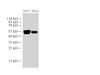 Western Blot analysis of A431 and Hela cells using CK14 Polyclonal Antibody at dilution of 1:30000.
