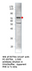 Estrogen Receptor alpha Antibody from Fabgennix