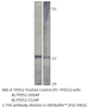 Prlz / TPD52 Antibody from Fabgennix