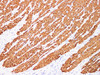 Immunohistochemistry of paraffinembedded Human colonic smooth muscle with Actin muscle specific(MSA) Monoclonal Antibody(Antigen repaired by EDTA).