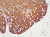 Immunohistochemistry of paraffinembedded Human colonic smooth muscle with Actin smooth muscle(SMA) Monoclonal Antibody(Antigen repaired by EDTA).