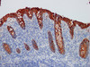 Immunohistochemistry of paraffinembedded Human appendix tissue with CEA Monoclonal Antibody(Antigen repaired by EDTA).