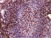 Immunohistochemistry of paraffinembedded Human tonsil tissue with CD2 Monoclonal Antibody(Antigen repaired by EDTA).