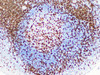 Immunohistochemistry of paraffinembedded Human tonsil tissue with CD3 Monoclonal Antibody(Antigen repaired by EDTA).