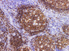 Immunohistochemistry of paraffinembedded Human lymph node tissue with CD19 Monoclonal Antibody(Antigen repaired by EDTA).