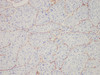 Immunohistochemistry of paraffinembedded Human liver tissue with CD34 Monoclonal Antibody(Antigen repaired by EDTA).